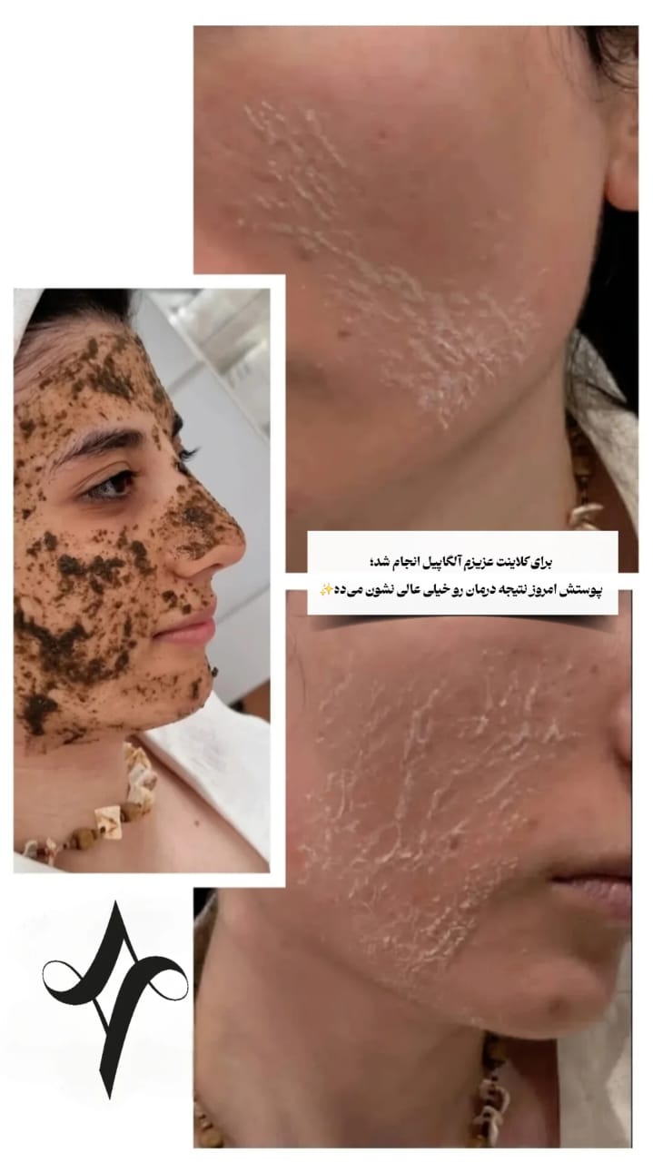 خدمات پاکسازی و درمان پوست یلدا اکبری در شیراز